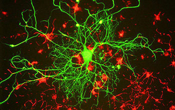 neurons_alzheimers_f.jpg